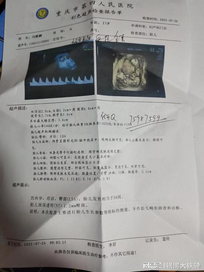 天津确诊病例曾前往唐山/天津疫情唐山密切接触者