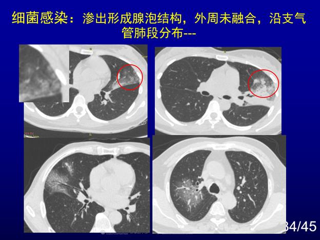 浙江省新型肺炎/浙江省关于新冠最新通知
