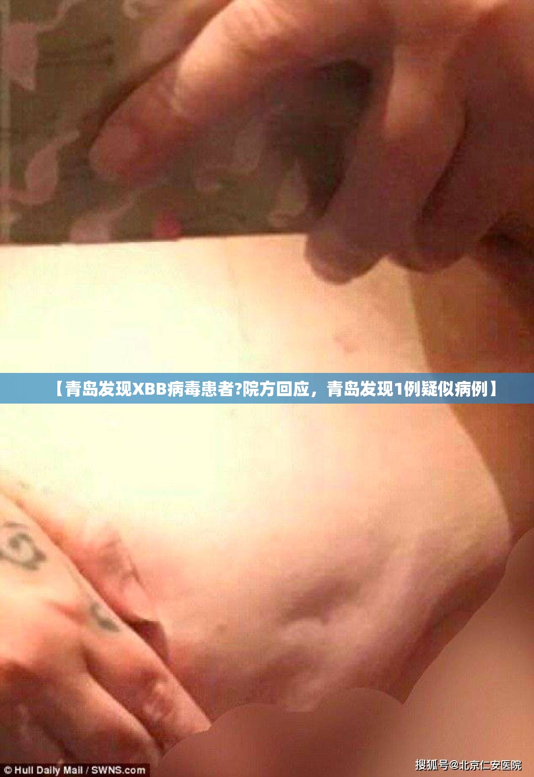 【青岛发现XBB病毒患者?院方回应，青岛发现1例疑似病例】