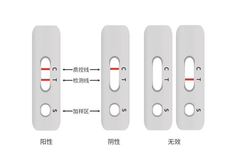 上海医院现疑似病例/上海医院发现疑似冠状病毒病人