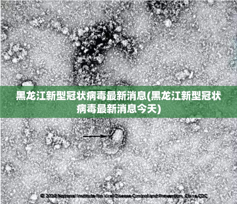 黑龙江新型冠状病毒最新消息(黑龙江新型冠状病毒最新消息今天)