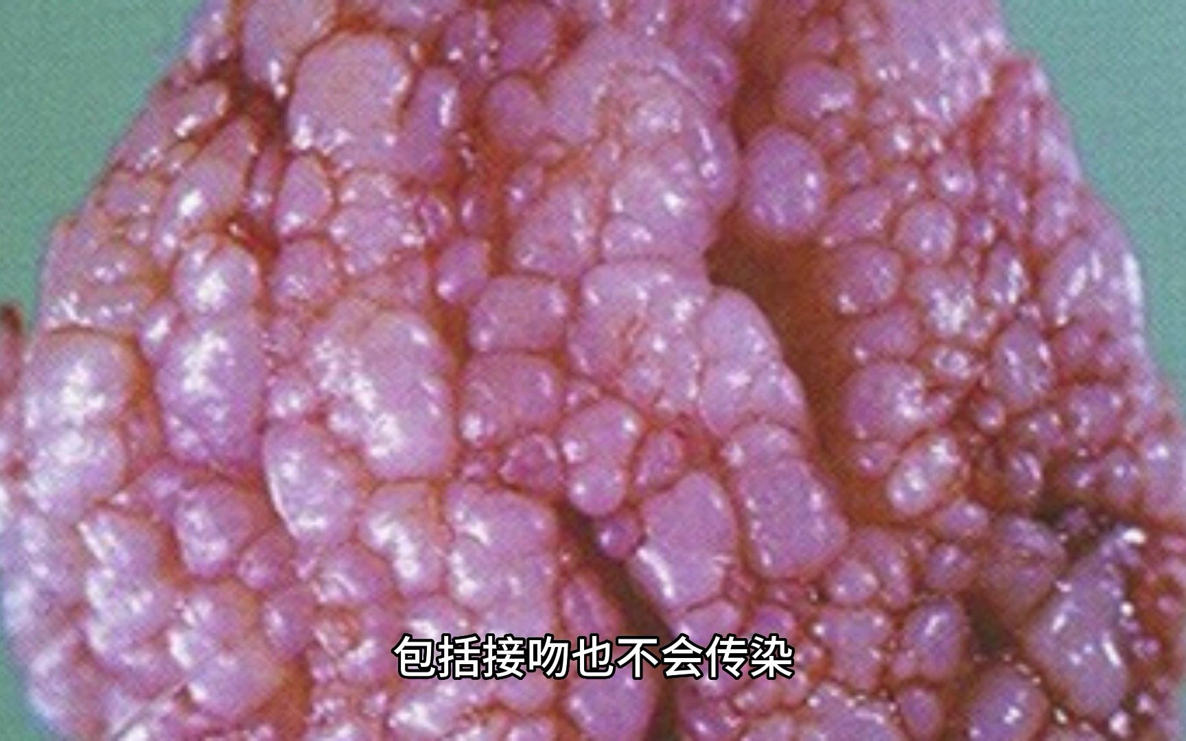 南京病毒/南京病毒尤肛门尖锐湿视频 南京病毒/南京病毒尤肛门尖锐湿视频