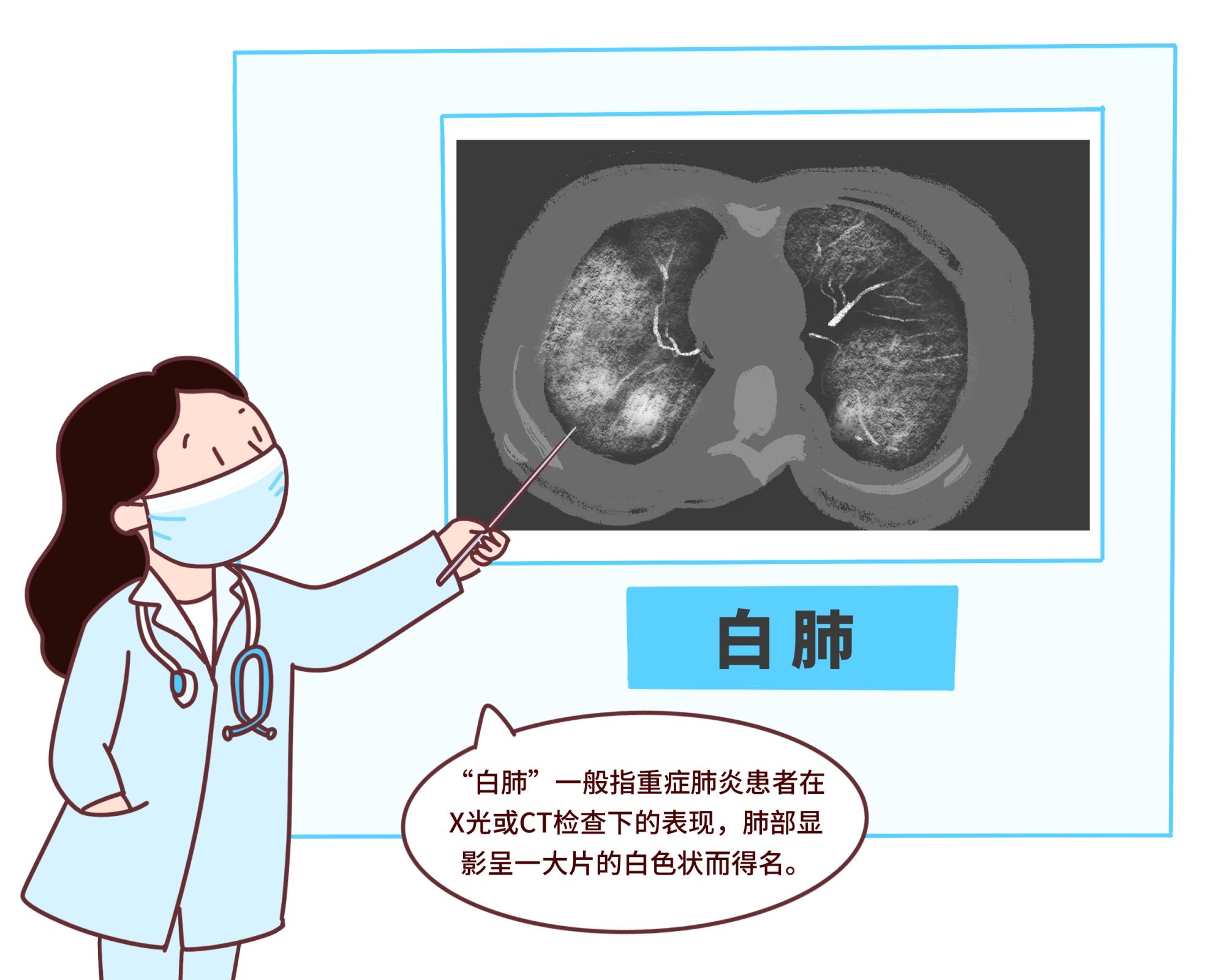 关于白肺和变异株的5个问答(白肺好转现象)